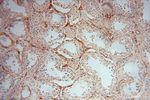 Moesin Antibody in Immunohistochemistry (Paraffin) (IHC (P))