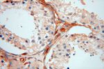 Moesin Antibody in Immunohistochemistry (Paraffin) (IHC (P))