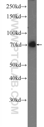 Moesin Antibody in Western Blot (WB)