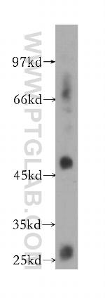 GPR137B Antibody in Western Blot (WB)