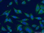 DNAJB14 Antibody in Immunocytochemistry (ICC/IF)
