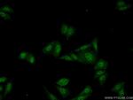 SDCCAG10 Antibody in Immunocytochemistry (ICC/IF)