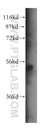 SDCCAG10 Antibody in Western Blot (WB)
