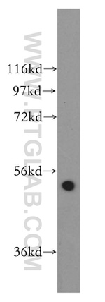 SDCCAG10 Antibody in Western Blot (WB)