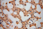 ARH3 Antibody in Immunohistochemistry (Paraffin) (IHC (P))