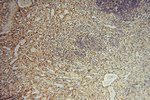 ARH3 Antibody in Immunohistochemistry (Paraffin) (IHC (P))