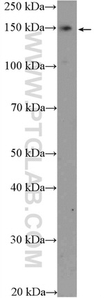 SUPT5H Antibody in Western Blot (WB)
