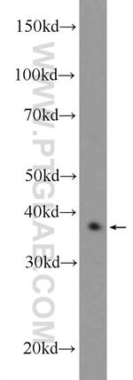 CXXC5 Antibody in Western Blot (WB)