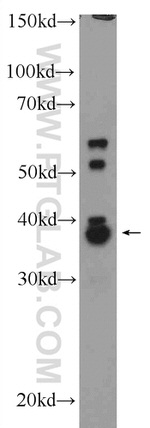 CXXC5 Antibody in Western Blot (WB)