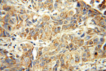 DUSP22 Antibody in Immunohistochemistry (Paraffin) (IHC (P))