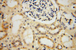 MRPL19 Antibody in Immunohistochemistry (Paraffin) (IHC (P))