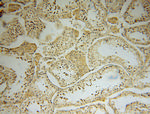 MRPL19 Antibody in Immunohistochemistry (Paraffin) (IHC (P))