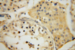 MRPL19 Antibody in Immunohistochemistry (Paraffin) (IHC (P))