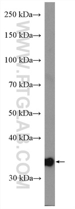 MRPL19 Antibody in Western Blot (WB)