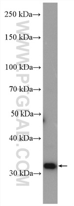 MRPL19 Antibody in Western Blot (WB)