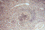 RNASEH2C Antibody in Immunohistochemistry (Paraffin) (IHC (P))