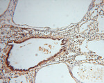RNASEH2C Antibody in Immunohistochemistry (Paraffin) (IHC (P))