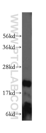 RNASEH2C Antibody in Western Blot (WB)