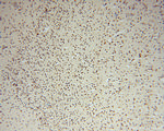 RNASEH2C Antibody in Immunohistochemistry (Paraffin) (IHC (P))