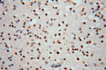 RNASEH2C Antibody in Immunohistochemistry (Paraffin) (IHC (P))