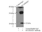 RNASEH2C Antibody in Immunoprecipitation (IP)