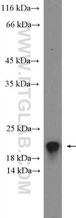 RNASEH2C Antibody in Western Blot (WB)