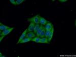 ARFGAP2 Antibody in Immunocytochemistry (ICC/IF)