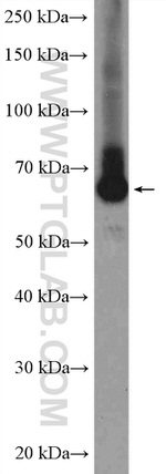 ARFGAP2 Antibody in Western Blot (WB)