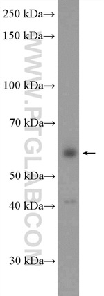 ARFGAP2 Antibody in Western Blot (WB)