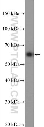 ARFGAP2 Antibody in Western Blot (WB)