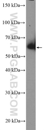 ARFGAP2 Antibody in Western Blot (WB)