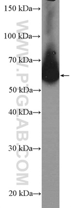 ARFGAP2 Antibody in Western Blot (WB)