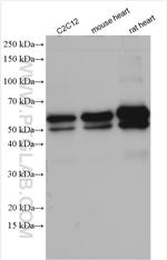 Desmin Antibody in Western Blot (WB)