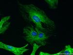 Desmin Antibody in Immunocytochemistry (ICC/IF)