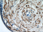 Desmin Antibody in Immunohistochemistry (Paraffin) (IHC (P))