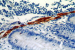 Desmin Antibody in Immunohistochemistry (Paraffin) (IHC (P))