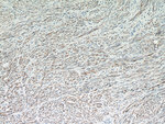 Desmin Antibody in Immunohistochemistry (Paraffin) (IHC (P))