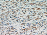 Desmin Antibody in Immunohistochemistry (Paraffin) (IHC (P))