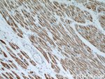 Desmin Antibody in Immunohistochemistry (Paraffin) (IHC (P))