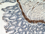 Desmin Antibody in Immunohistochemistry (Paraffin) (IHC (P))