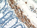 Desmin Antibody in Immunohistochemistry (Paraffin) (IHC (P))