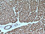 Desmin Antibody in Immunohistochemistry (Paraffin) (IHC (P))