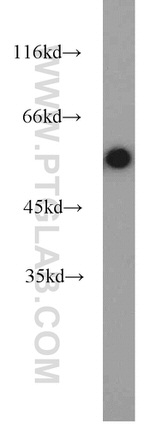 Desmin Antibody in Western Blot (WB)