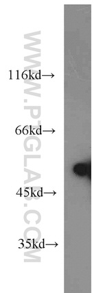 Desmin Antibody in Western Blot (WB)