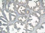 PMEPA1 Antibody in Immunohistochemistry (Paraffin) (IHC (P))
