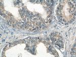 PMEPA1 Antibody in Immunohistochemistry (Paraffin) (IHC (P))