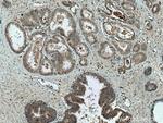 PMEPA1 Antibody in Immunohistochemistry (Paraffin) (IHC (P))