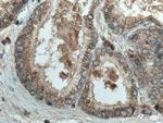 PMEPA1 Antibody in Immunohistochemistry (Paraffin) (IHC (P))