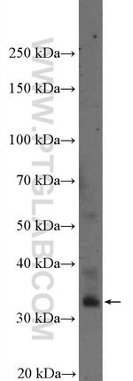 PMEPA1 Antibody in Western Blot (WB)
