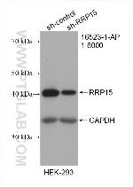 RRP15 Antibody in Western Blot (WB)